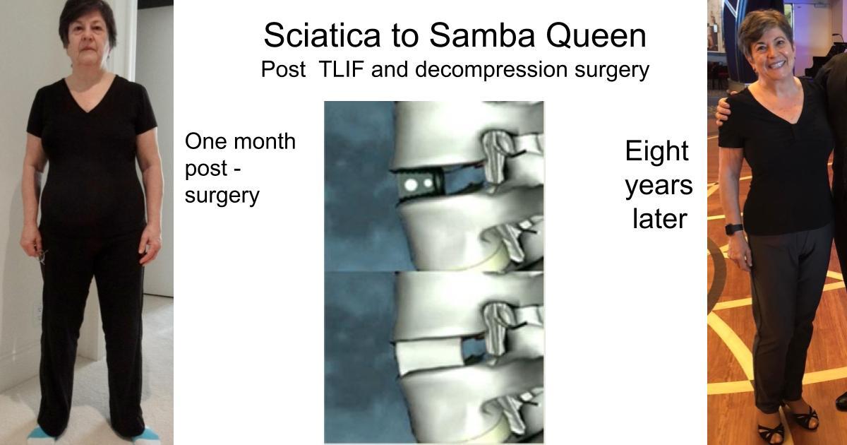 Sciatica to Samba Queen Sciatica to Samba Queen