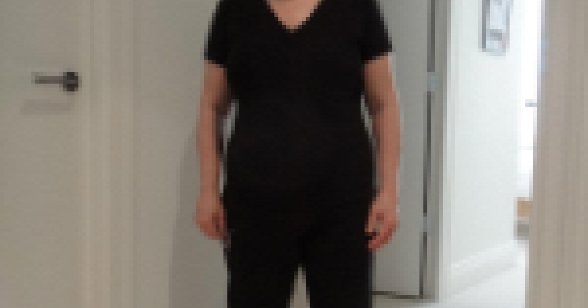 Spine Surgery Rehabilitation: Six Months post-surgery Spine Surgery Rehabilitation: Six Months post-surgery